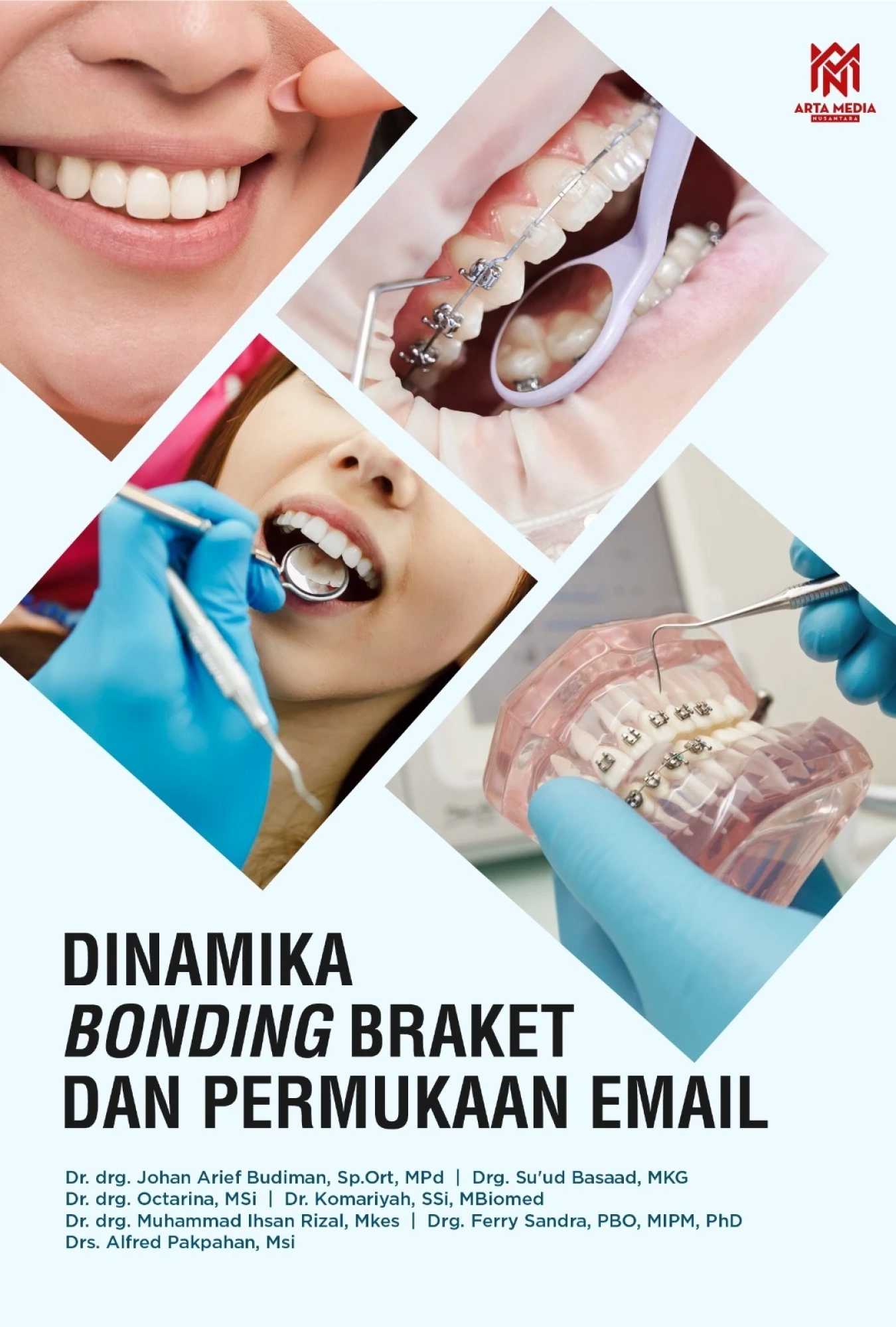 Dinamika Bonding Braket dan Permukaan Email