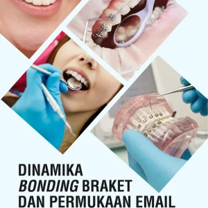 Dinamika Bonding Braket dan Permukaan Email