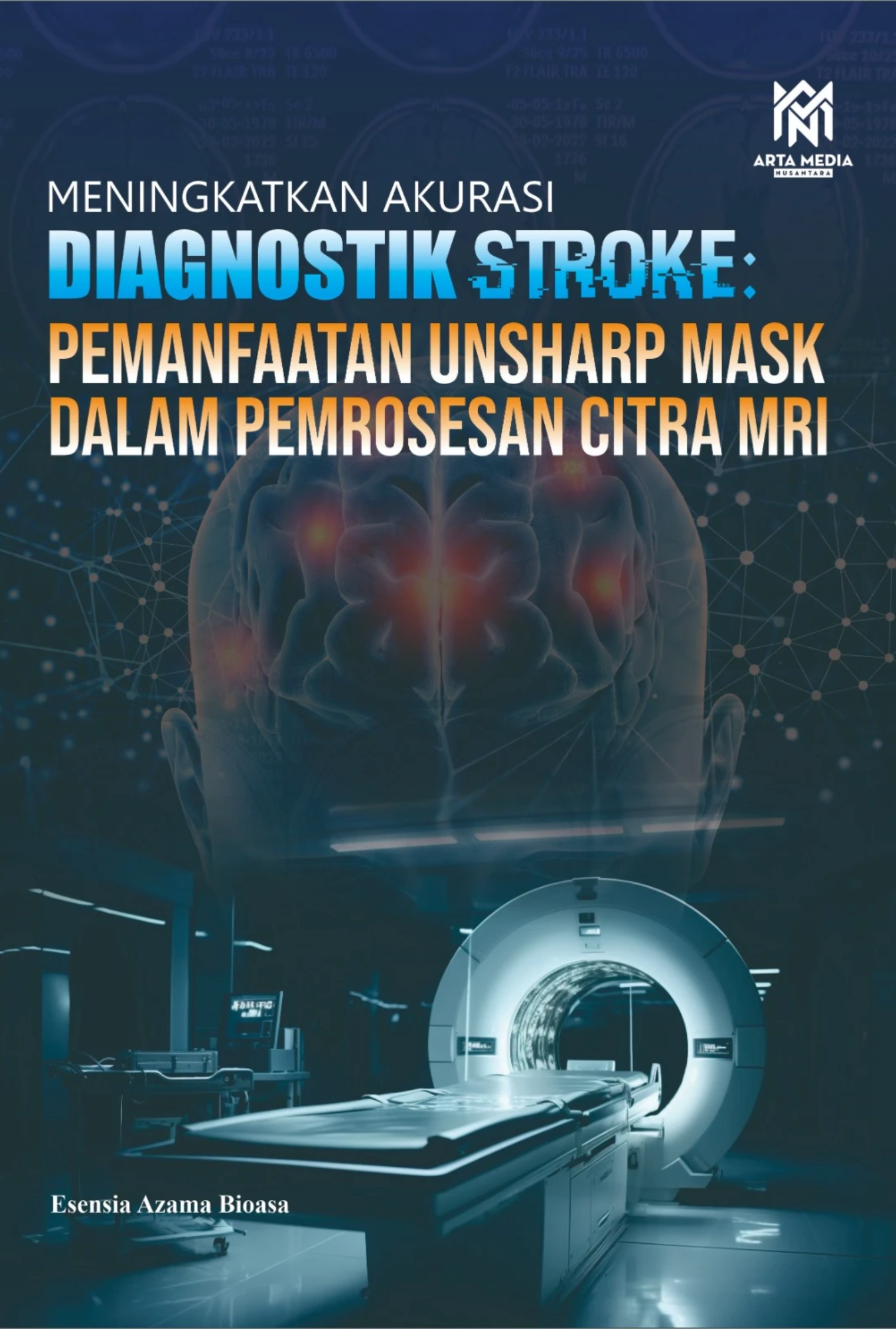 Meningkatkan Akurasi Diagnostik Stroke