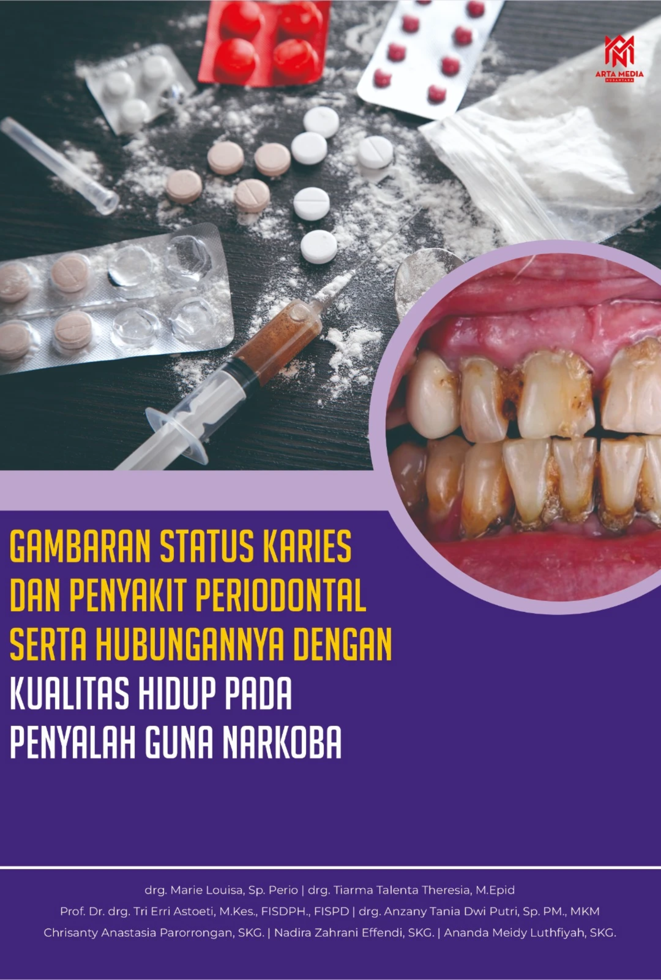 Gambaran Status Karies dan Penyakit Periodontal serta Hubungannya dengan Kualitas Hidup pada Penyalah Guna Narkoba