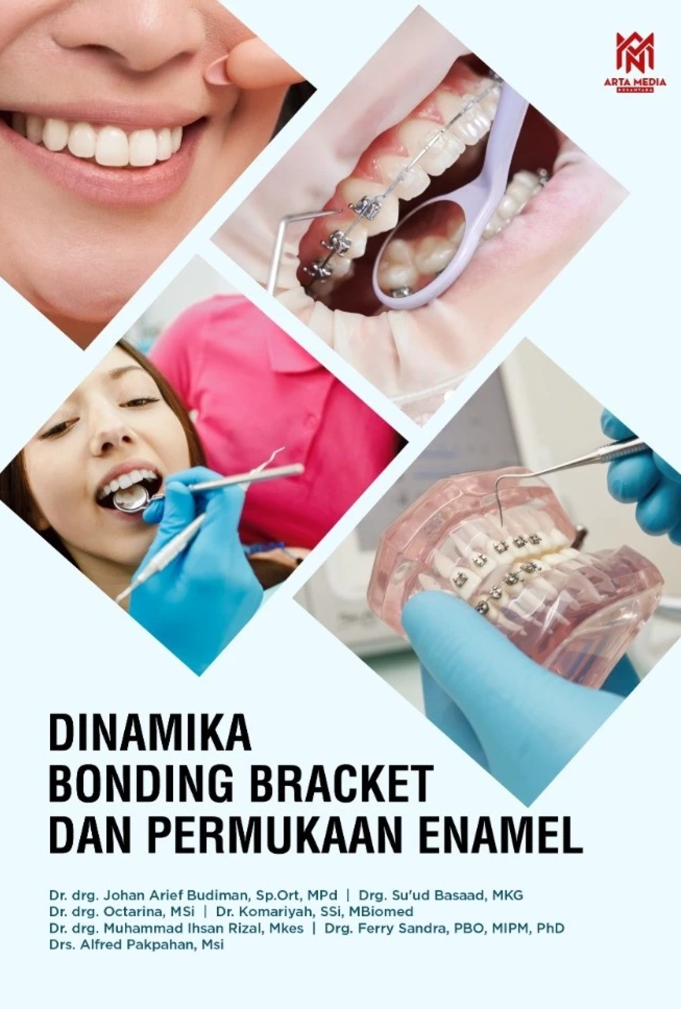 Dinamika Bonding Bracket dan Permukaan Enamel