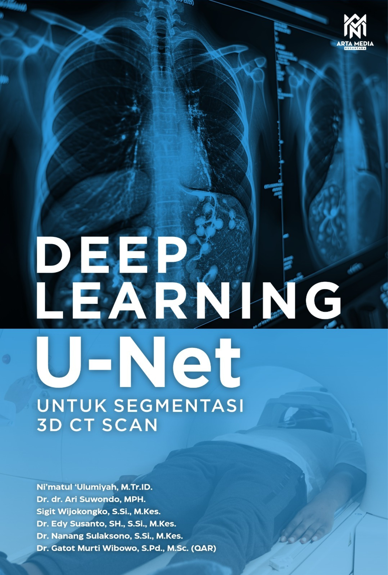 Deep Learning U-Net untuk Segmentasi 3D CT Scan