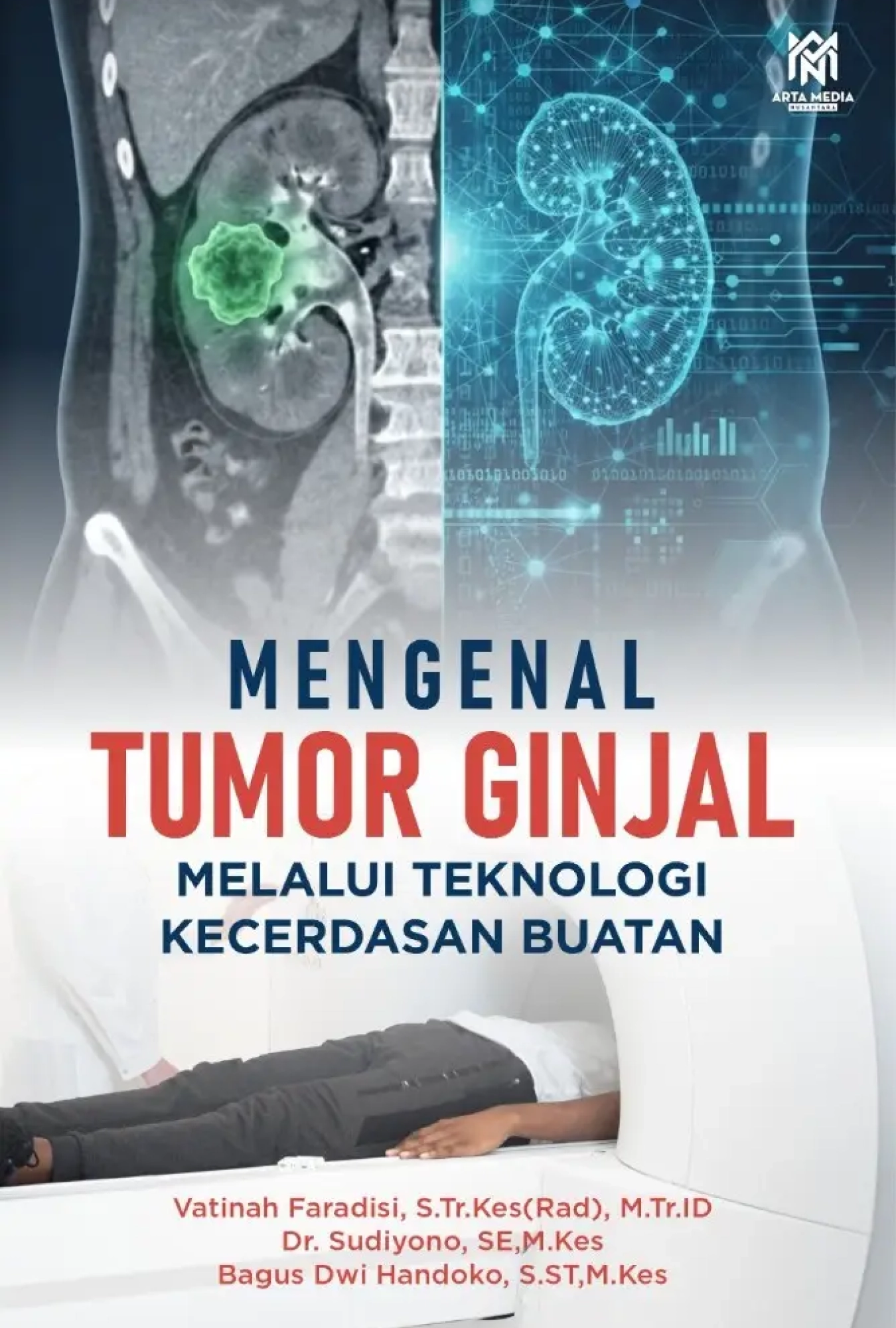 Mengenal Tumor Ginjal Melalui Teknologi Kecerdasan Buatan